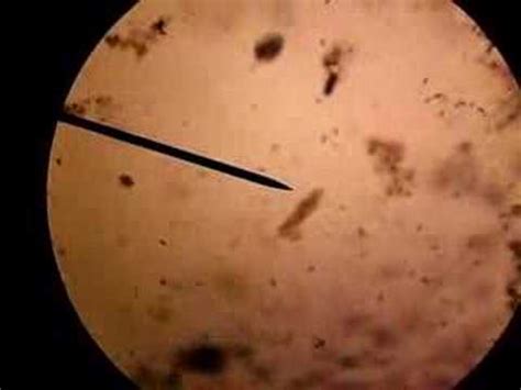 PROTISTA moving under microscope - YouTube