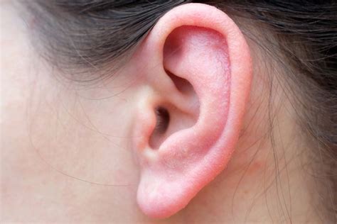 Dry Skin in Ears: Causes and Treatment