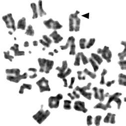 Involvement of different chromosomes in aneuploid combinations. | Download Scientific Diagram