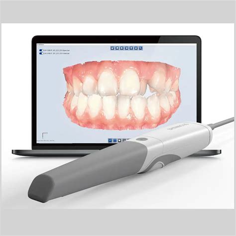 How An Intra-oral Scanner works? ~ Dr. Bharat Katarmal Dental & Implant Clinic