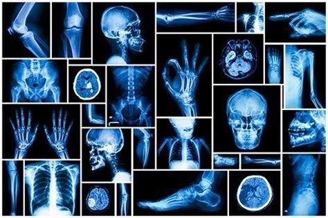 Cursos de radiologia gratis 2023 - Interpretar radiografías ...