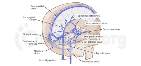 Sigmoid Sinus