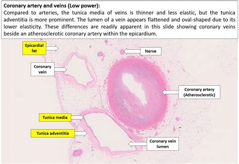 Blood vessels – Normal Histology – NUS Pathweb :: NUS Pathweb