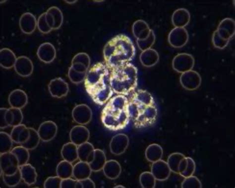 Dark Field Microscopy - Live Blood Online