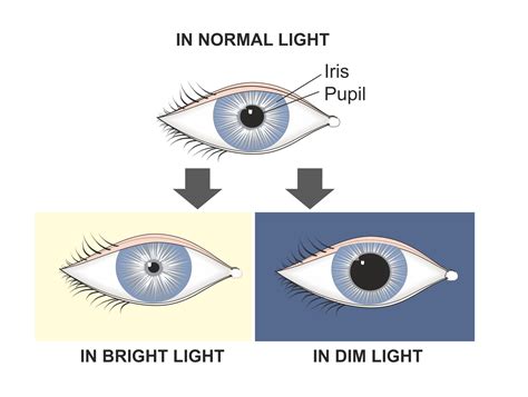 What To Expect When You Have Your Pupils Dilated | Eye Consultants of Fargo