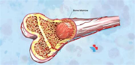 Every Thing About Bone Marrow Transplant | GOMED