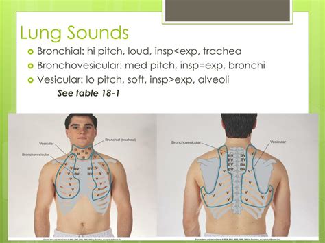 Types of lung sounds - ffbooy