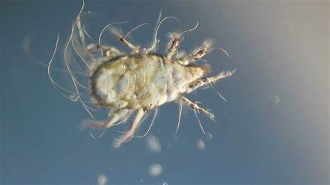 Mite Under Microscope