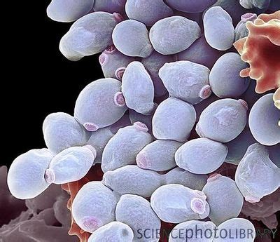 Candida albicans (Pathogenesis) - microbewiki