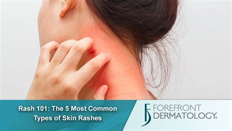 Rash 101: The 5 Most Common Types of Skin Rashes - Forefront Dermatology