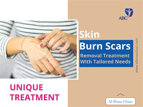 Skin burn scars and removal treatment - Al Biraa Clinic