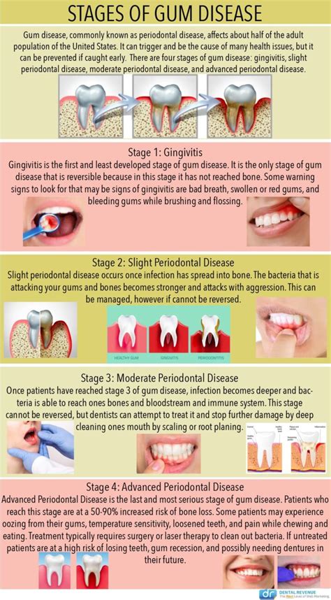 Periodontal Services Plano TX | Gum Disease Treatment Dallas