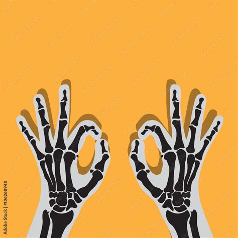 X-ray hand fracture Stock Illustration | Adobe Stock