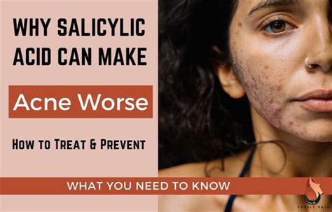 7 Reasons Salicylic Acid can make Acne Worse & What to Do - Sasily Skin