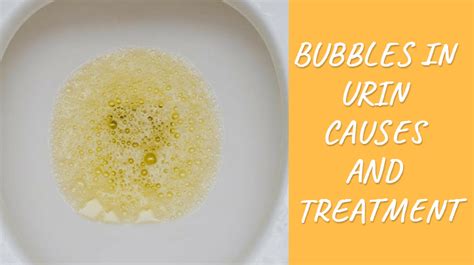 Learn Reason of having Bubbles In Urine and Is It Ok for Health?