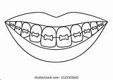 Coloring Pages Kids With Braces sketch template
