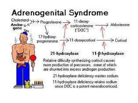 Congenital adrenal hyperplasia