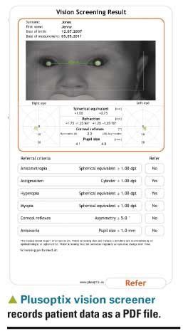 Vision Screening | RB Instruments