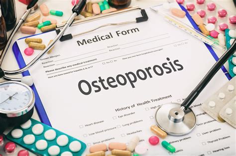 New Osteoporosis Treatment Options on the Horizon - Endocrinology Advisor