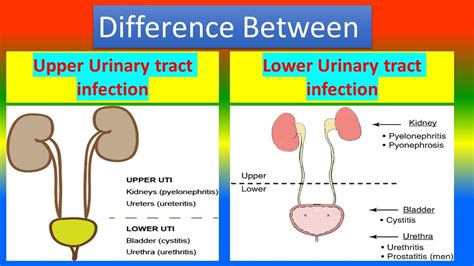 Upper Urinary tract infection Vs. Lower Urinary tract infection - YouTube