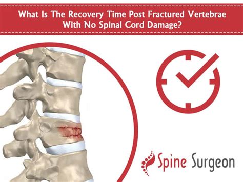 What Is The Recovery Time Post Fractured Vertebrae With No Spinal Cord Damage? | Spine Surgeon