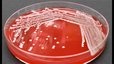 Bacterial Colony Description - YouTube