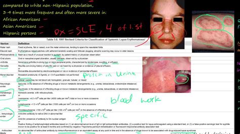 89P Systemic lupus erythematosus, SLE, how to diagnosis, Etiology and Pathogenesis - YouTube