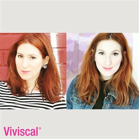 36 best images about Viviscal Before & After on Pinterest | Study ...