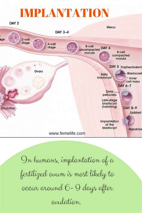 Pin on IVF