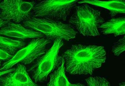 10 Different Cell Morphology Assays & When to Use Them