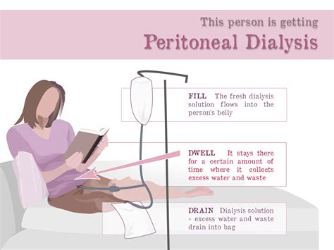 Peritoneal Dialysis Catheter Types