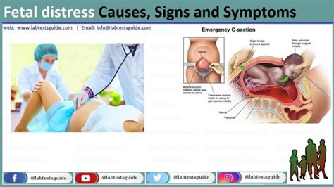 Fetal distress Causes, Symptoms, and Signs - Lab Tests Guide