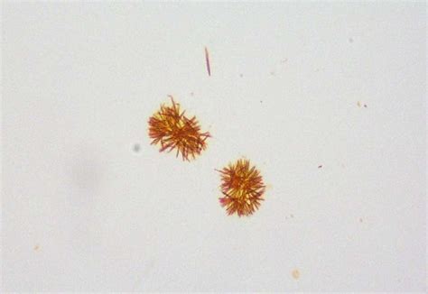 Urine bilirubin crystals - common in canine - abnormal in other species ...