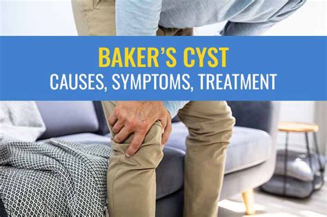 Baker’s cyst causes, symptoms, and treatment options (conservative vs ...