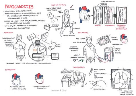 Pericarditis | Nursing notes, Concept map nursing, Nurse study notes