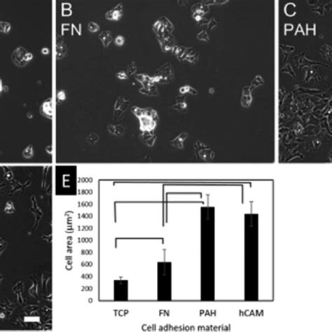 (A−D) HepG2 cell morphology on the four cell adhesion materials. Cells ...