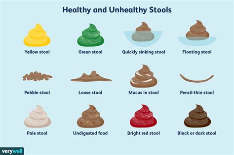 Yellow Poop Color Chart