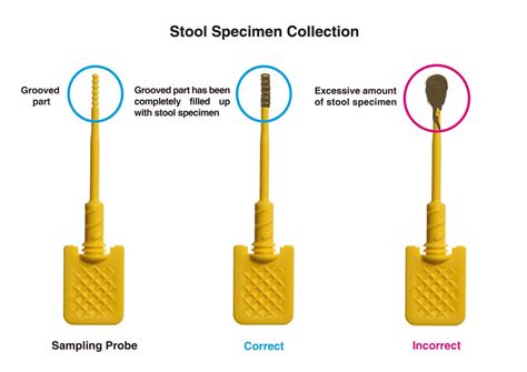 How to collect stool specimen | Prevent Colorectal Cancer