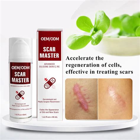 Oem High Quality Natural Skin Tight Anti-cellulite Scar Remover Face Keloid Scar Removal Cream ...