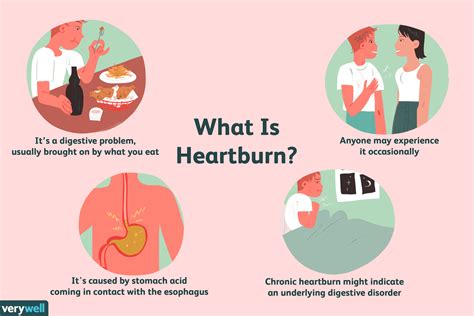 Heartburn Causes