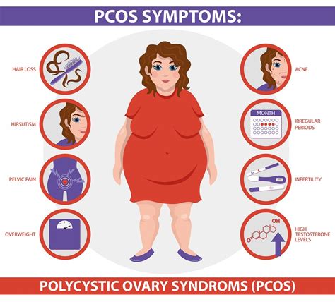 Pcos Symptoms Infographic. Polycystic Ovary Syndrome. Detailed V – Dr ...