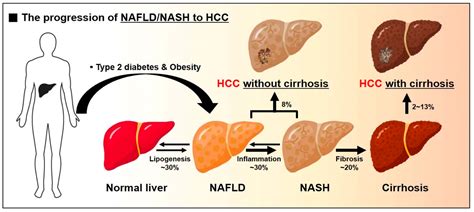 IJMS | Free Full-Text | Metabolic Spectrum of Liver Failure in Type 2 ...