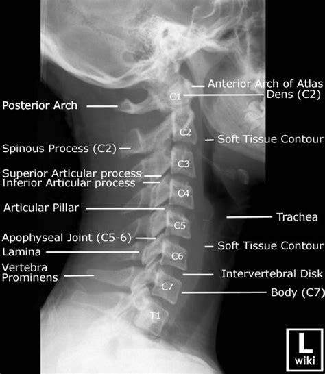 Cervical Spine Anatomy — Connect Physical Therapy