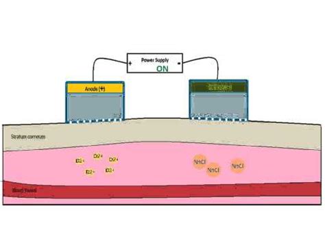 Octreotide Scan