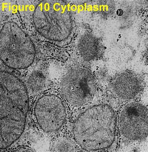 Ribosomes Electron Micrograph