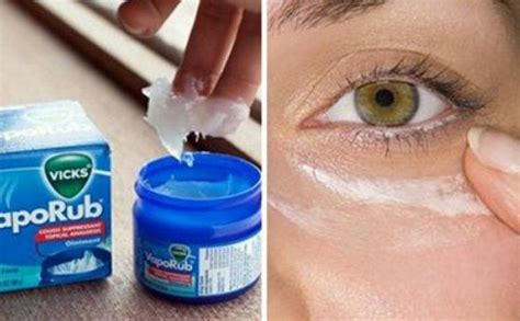 Here Are 8 Unusual Ways That You Can Use Vicks VapoRub