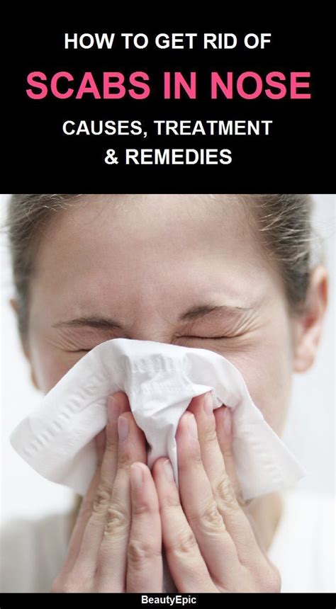 How to Get Rid of Scabs in Nose, Causes, Treatment, Remedies | Dry nose ...