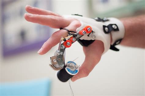 Bloke who lost his finger creates in-expensive prosthetic fingers for ...