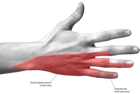 Ulnar neuropathy causes, symptoms, diagnosis, treatment & exercises