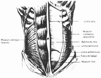 RBCP - Spiegelian Hernia Secondary to Abdominoplasty